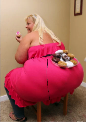 Overweight is not about beauty!
